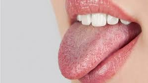 dry mouth causes remes and