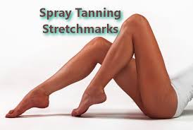 spray tan hide stretch marks or scars