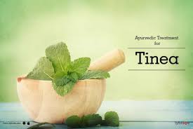 for tinea ringworm fungal infection