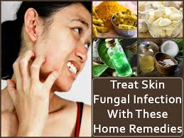 treat skin fungal infection