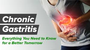 chronic gastritis what is it causes