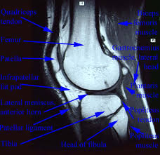 Knee joint anatomy is complex with muscles, ligaments, cartilage and tendons. Department Of Anatomy Med Univ Of Warsaw Poland Knee Mri Scan 44