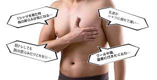 女性化乳房形成術｜横浜で美容外科・美容整形なら横浜中央クリニック