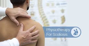 can physiotherapy treat scoliosis