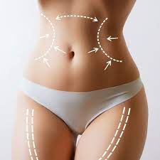 360 Liposuction in Dubai | Lipo 360 Cost