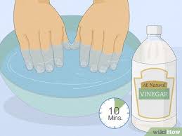 get rid of white spots on your nails