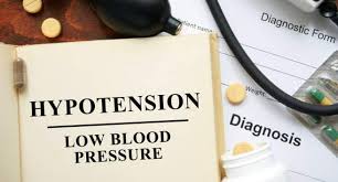 hypotension symptoms diagnosis