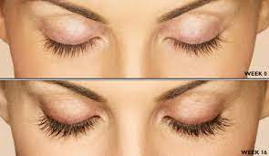 Use latisse for eyelashes growth and get longer,thicker and darker eyelashes in 8 weeks! Latisse For The Growth Of Eyelashes Eyelash Growth Serum Webeyeclinic