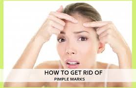 pimple marks and acne scars