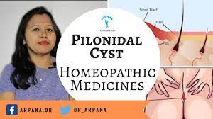 best homeopathic treatment