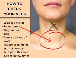 thyroid disease symptoms and