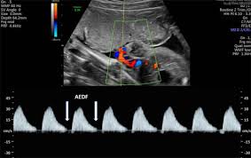doppler ultrasound in obstetrics