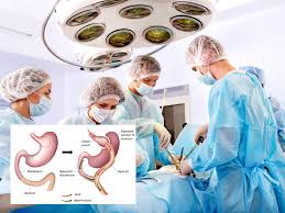 how does bariatric surgery work