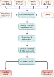 Chronic Venous Insufficiency An Overview Sciencedirect