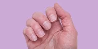 brittle nails causes and ways to