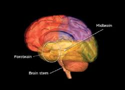 Ischemic, due to lack of blood flow, and hemorrhagic, due to bleeding. Brain Stem Stroke American Stroke Association