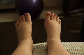 when to see a doctor for swollen feet