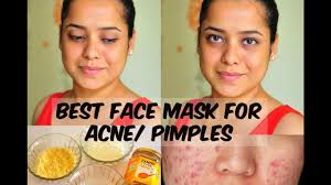 face mask for pimples acne besan
