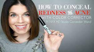 conceal redness and acne with makeup