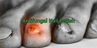 antifungal nail polish