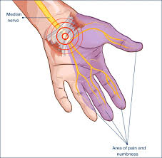 hand and wrist orthopaedic center of