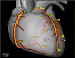 Abcdefgh is a regular octagon in which longest diagonal is ae and shortest diagonal is ac. The Radiology Assistant Coronary Anatomy And Anomalies