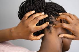 what causes scalp tenderness
