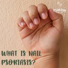 nail psoriasis causes symptoms and