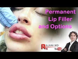 permanent lip filler and options dr