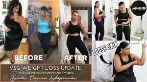 11 month vsg weight loss update