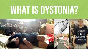 dystonia causes types symptoms