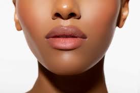 how long does lip filler bruising