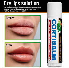 dan s lip balm cortibalm for your skin