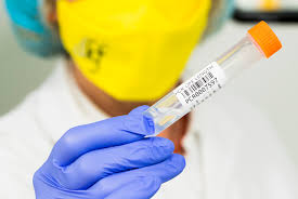 test antígenos cuanativo único en el