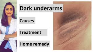how to get rid of dark underarms