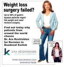 revisional weight loss surgery dssurgery