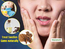 do you have swollen gums here are some