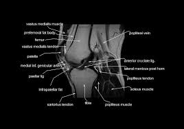 Want to learn more about it? Mri Knee Anatomy Knee Sagittal Anatomy Free Cross Sectional Anatomy Knee Mri Mri Anatomy