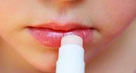 chapped lips symptoms causes and