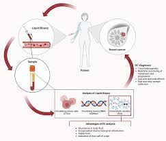 liquid biopsy for t cancer bc