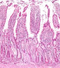 Take care of them and life is much more comfortable. Intestinal Gland Wikipedia