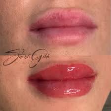 lip tattoo treatments sarah gibb