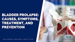 bladder prolapse causes symptoms