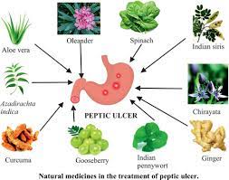 treatment of peptic ulcer