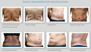 about coolsculpting fort lauderdale