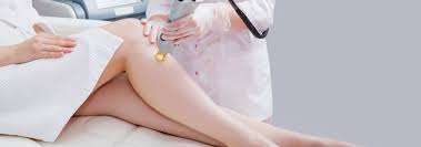 laser hair removal during pregnancy is