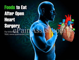 Diet After Open Heart Surgery Foods To Eat Foods To Avoid
