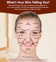 10 Things Acne Means About Your Health Drjockers Com