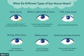 types of eye mucus discharge and boogers