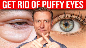 get rid of puffy eyes for good with dr